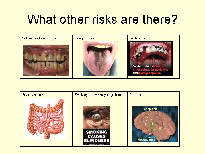 What other risks are there? Yellow teeth and sore gums Hairy tongue Rotten teeth