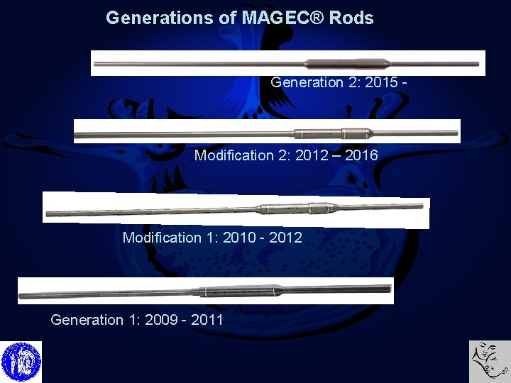 Generations of MAGEC® Rods Generation 2: 2015 - Modification 2: 2012 – 2016 Modification