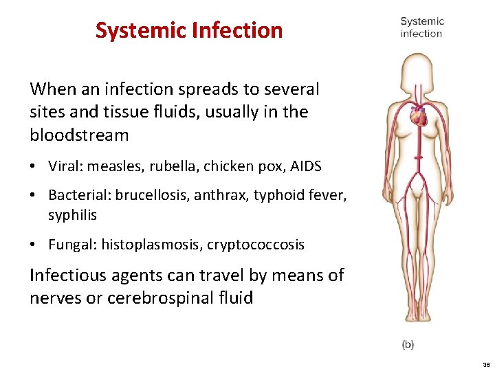 Systemic Infection When an infection spreads to several sites and tissue fluids, usually in