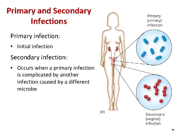 Primary and Secondary Infections Primary infection: • Initial infection Secondary infection: • Occurs when