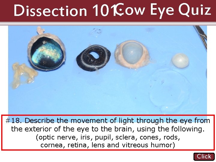 Dissection 101: Cow Eye Quiz #18. Describe the movement of light through the eye