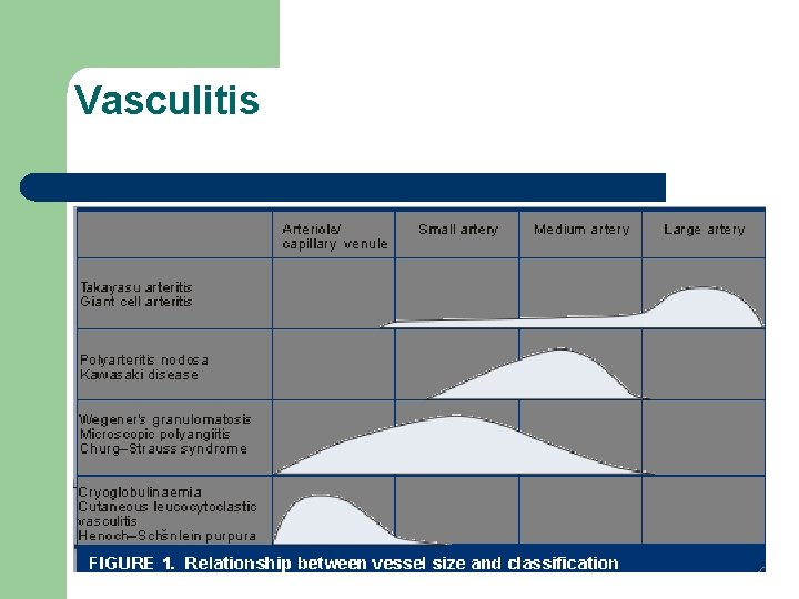 Vasculitis Vasculitis