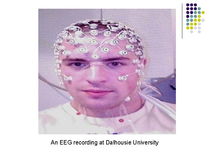 An EEG recording at Dalhousie University 