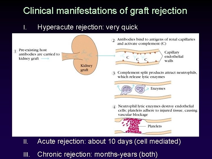 Clinical manifestations of graft rejection I. Hyperacute rejection: very quick II. Acute rejection: about