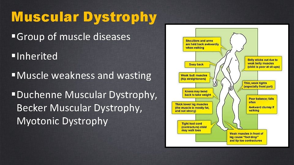 Muscular Dystrophy § Group of muscle diseases § Inherited § Muscle weakness and wasting