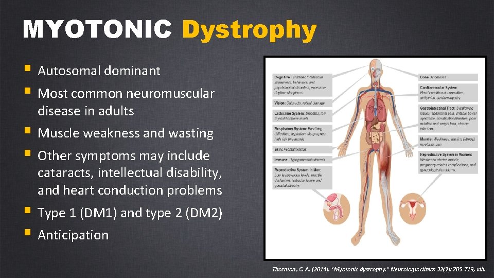 MYOTONIC Dystrophy § Autosomal dominant § Most common neuromuscular disease in adults § Muscle