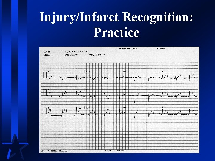 Injury/Infarct Recognition: Practice 