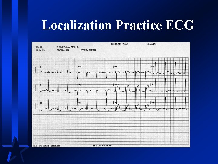 Localization Practice ECG 