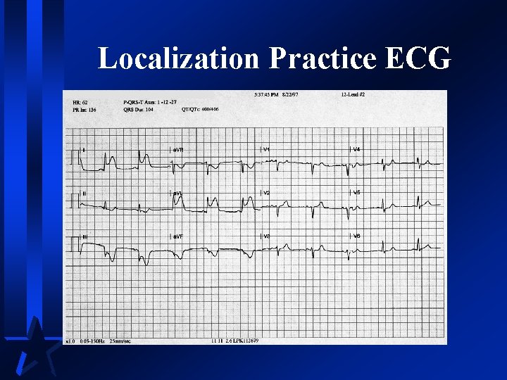 Localization Practice ECG 