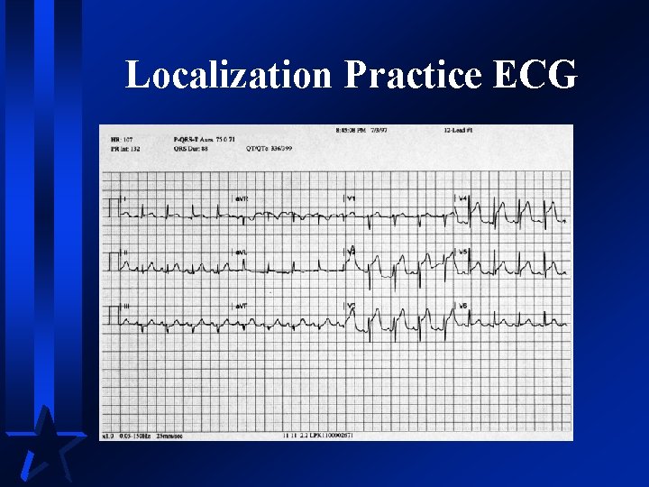 Localization Practice ECG 