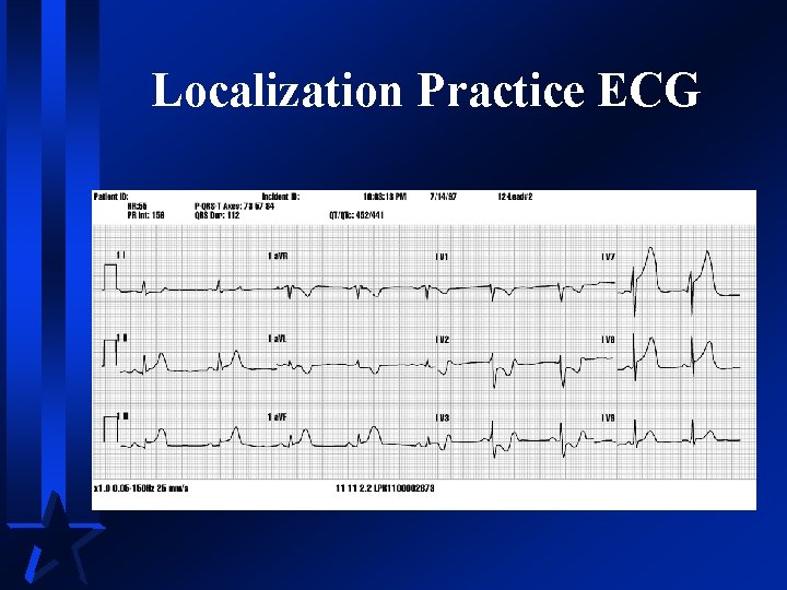 Localization Practice ECG 
