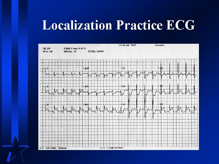 Localization Practice ECG 