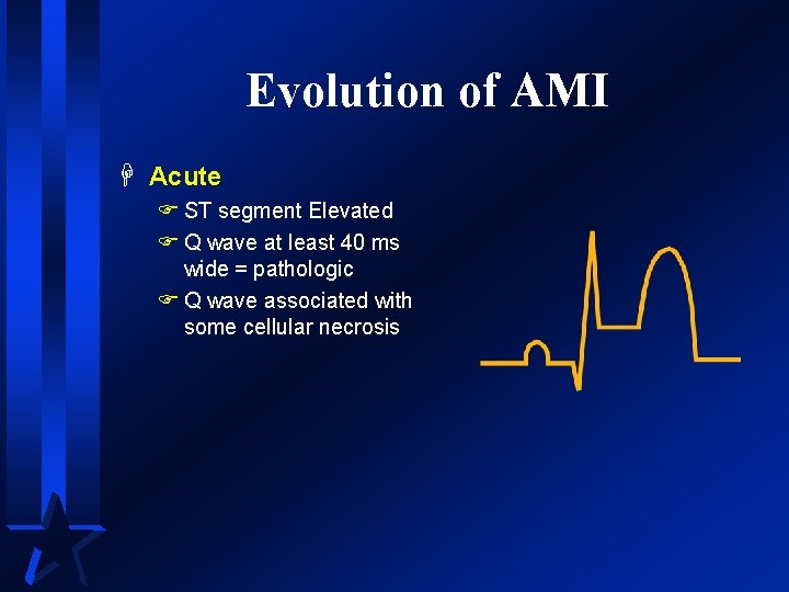 Evolution of AMI H Acute F ST segment Elevated F Q wave at least