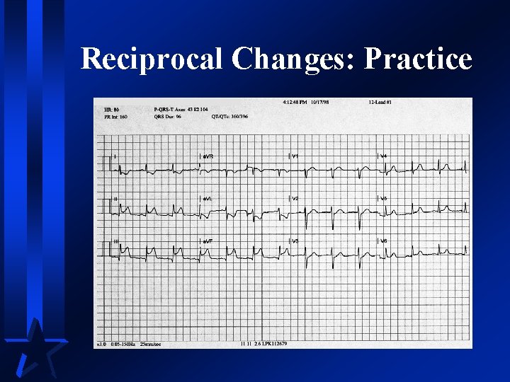 Reciprocal Changes: Practice 