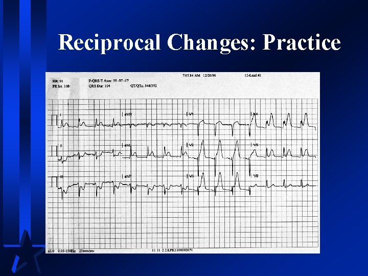 Reciprocal Changes: Practice 