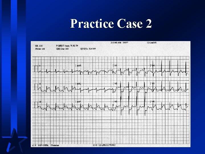 Practice Case 2 