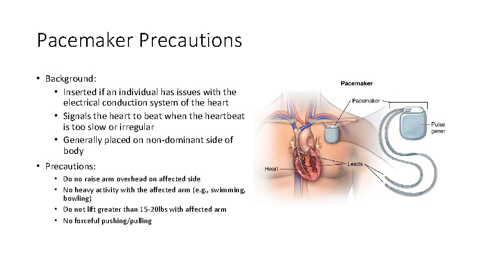 Pacemaker Precautions • Background: • Inserted if an individual has issues with the electrical
