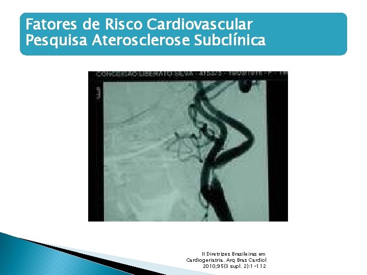 Fatores de Risco Cardiovascular Pesquisa Aterosclerose Subclínica II Diretrizes Brasileiras em Cardiogeriatria. Arq Bras