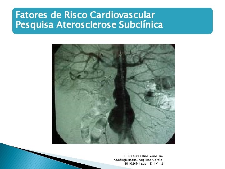 Fatores de Risco Cardiovascular Pesquisa Aterosclerose Subclínica II Diretrizes Brasileiras em Cardiogeriatria. Arq Bras