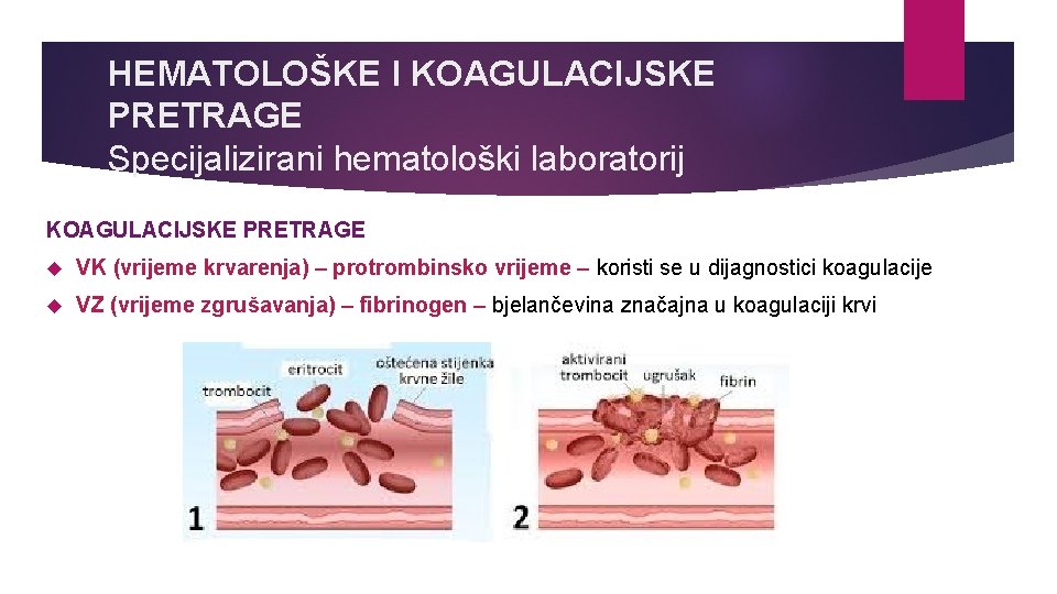 HEMATOLOŠKE I KOAGULACIJSKE PRETRAGE Specijalizirani hematološki laboratorij KOAGULACIJSKE PRETRAGE VK (vrijeme krvarenja) – protrombinsko