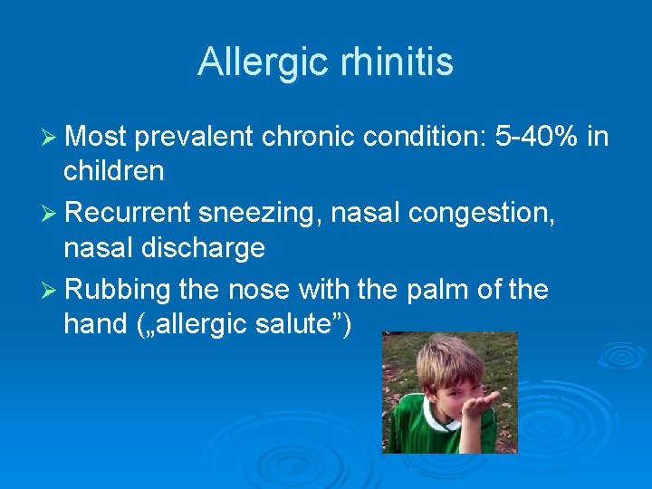 Allergic rhinitis Ø Most prevalent chronic condition: 5 -40% in children Ø Recurrent sneezing,