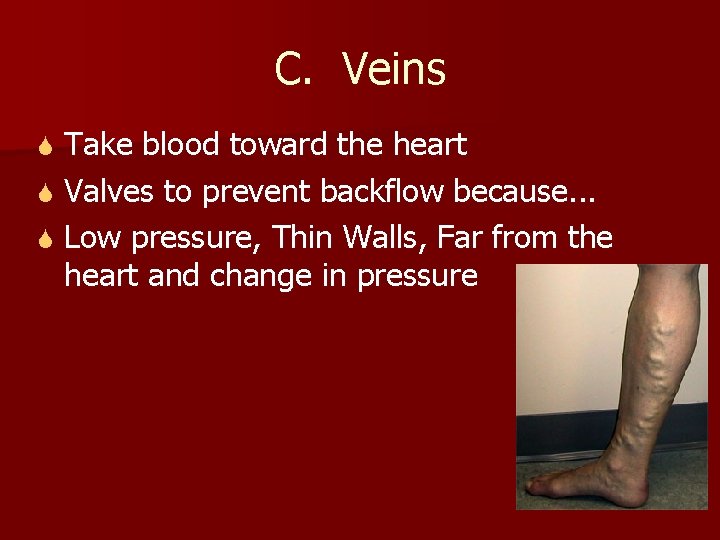C. Veins Take blood toward the heart S Valves to prevent backflow because. .