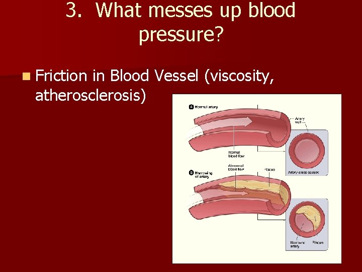 3. What messes up blood pressure? n Friction in Blood Vessel (viscosity, atherosclerosis) 