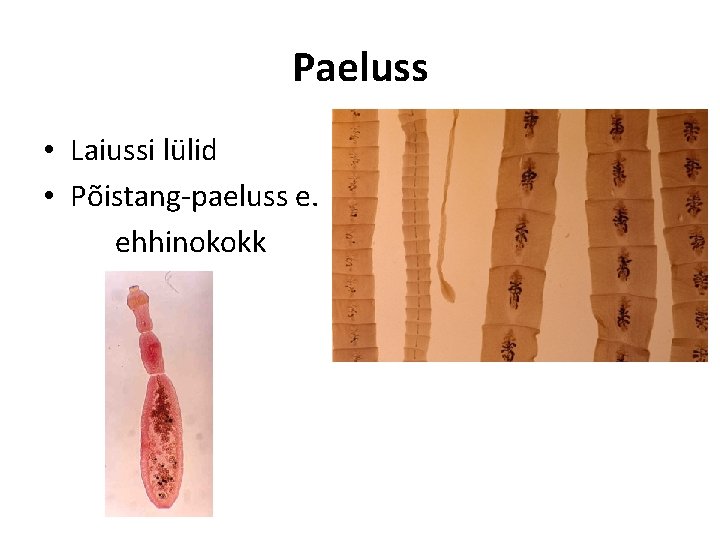 Paeluss • Laiussi lülid • Põistang-paeluss e. ehhinokokk 