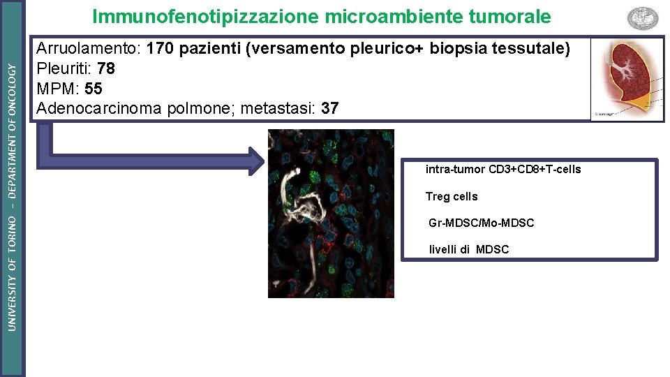 UNIVERSITY OF TORINO – DEPARTMENT OF ONCOLOGY Immunofenotipizzazione microambiente tumorale Arruolamento: 170 pazienti (versamento