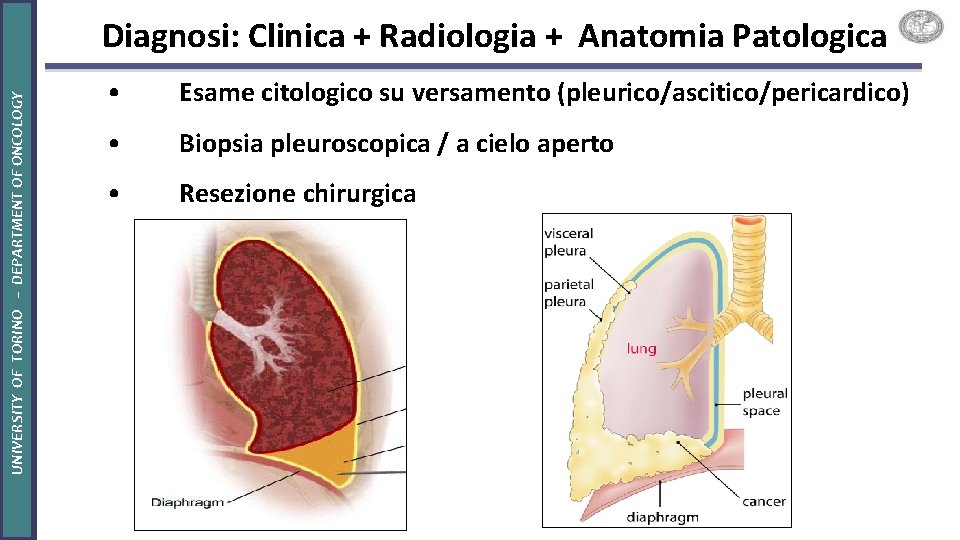 UNIVERSITY OF TORINO – DEPARTMENT OF ONCOLOGY Diagnosi: Clinica + Radiologia + Anatomia Patologica