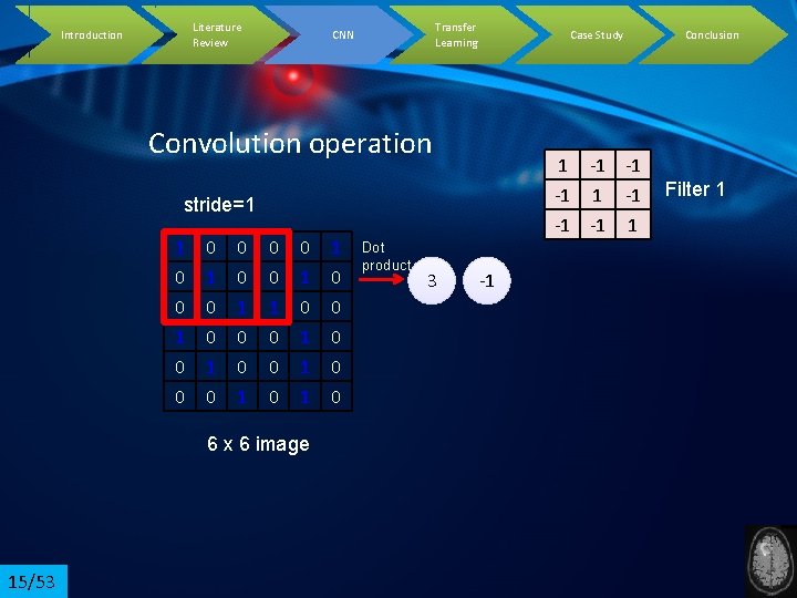 Literature Review Introduction Transfer Learning CNN Case Study Convolution operation 1 -1 -1 -1