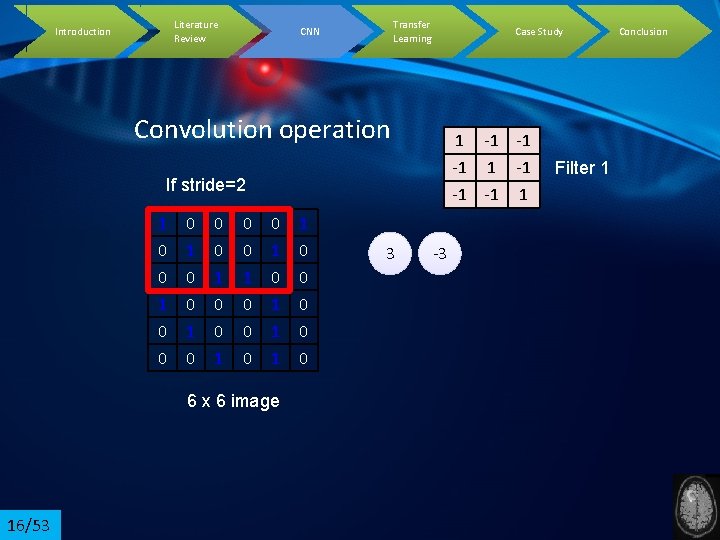 Literature Review Introduction Transfer Learning CNN Case Study Convolution operation 1 -1 -1 -1