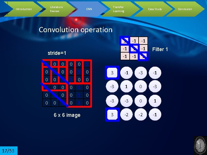 Literature Review Introduction Transfer Learning CNN Case Study Convolution operation 1 -1 -1 -1