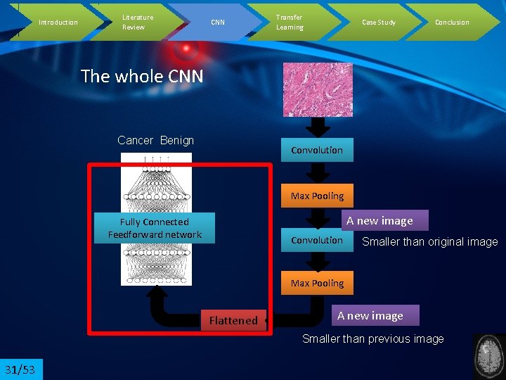 Introduction Literature Review CNN Transfer Learning Case Study Conclusion The whole CNN Cancer Benign