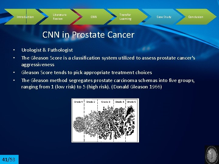 Introduction Literature Review CNN Transfer Learning Case Study Conclusion CNN in Prostate Cancer •