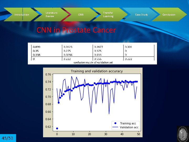 Introduction Literature Review CNN Transfer Learning CNN in Prostate Cancer 45/53 Case Study Conclusion