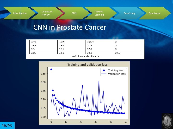 Introduction Literature Review CNN Transfer Learning CNN in Prostate Cancer 46/53 Case Study Conclusion