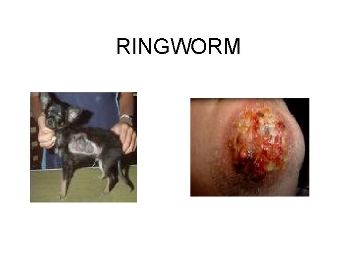 RINGWORM 