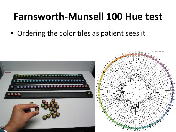 Farnsworth-Munsell 100 Hue test • Ordering the color tiles as patient sees it 