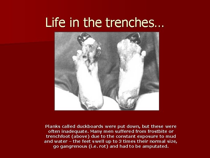 Life in the trenches… Planks called duckboards were put down, but these were often