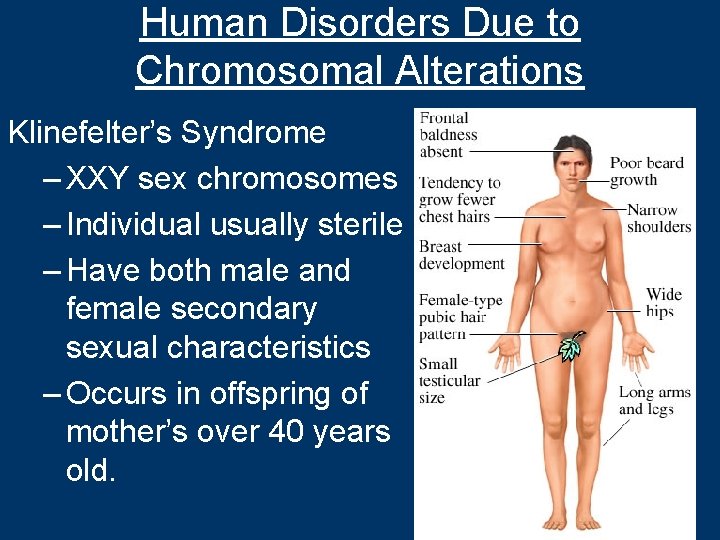 Human Disorders Due to Chromosomal Alterations Klinefelter’s Syndrome – XXY sex chromosomes – Individual
