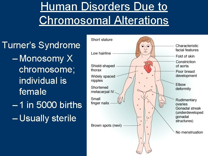 Human Disorders Due to Chromosomal Alterations Turner’s Syndrome – Monosomy X chromosome; individual is