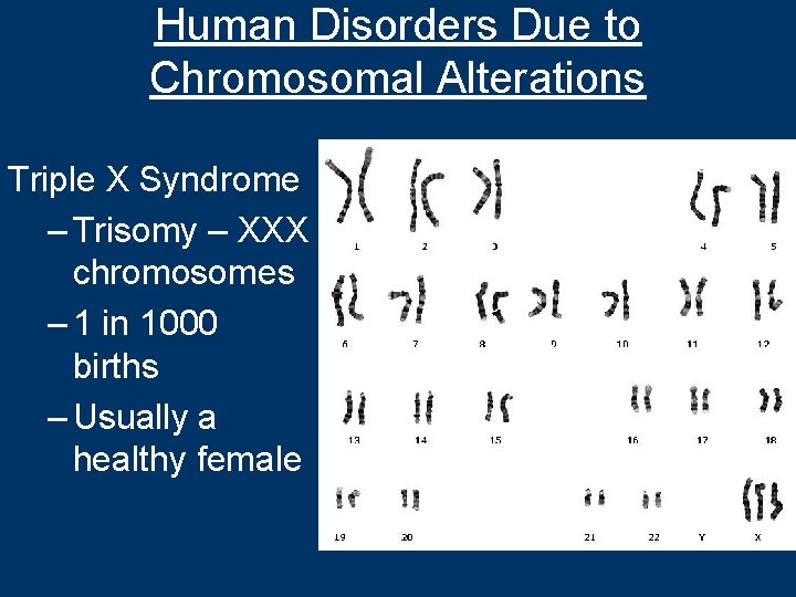 Human Disorders Due to Chromosomal Alterations Triple X Syndrome – Trisomy – XXX chromosomes