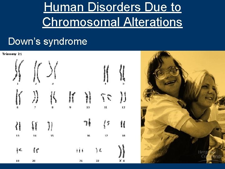 Human Disorders Due to Chromosomal Alterations Down’s syndrome 