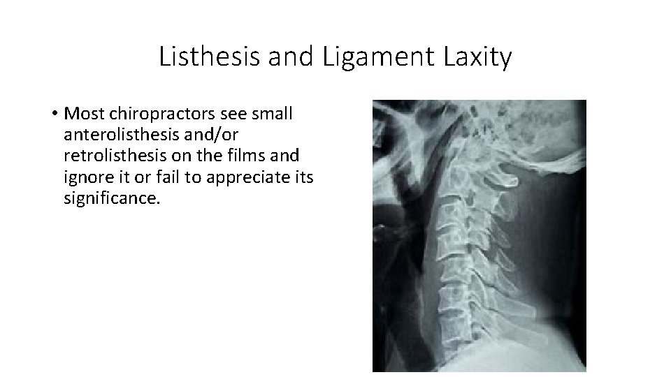 Spinal Imaging and the Differential Diagnosis of Permanent