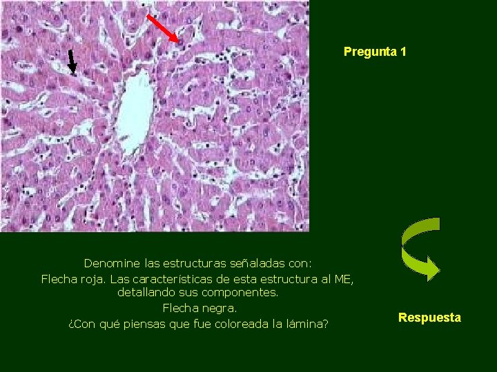 Pregunta 1 Denomine las estructuras señaladas con: Flecha roja. Las características de esta estructura Pregunta 1 Denomine las estructuras señaladas con: Flecha roja. Las características de esta estructura