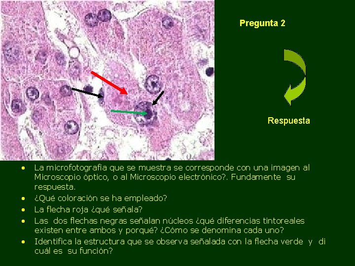 Pregunta 2 Respuesta • • • La microfotografía que se muestra se corresponde con