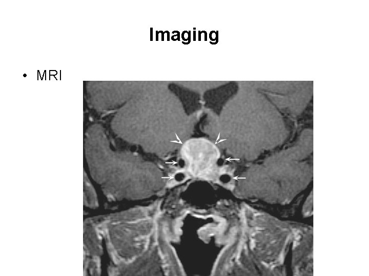 Imaging • MRI 