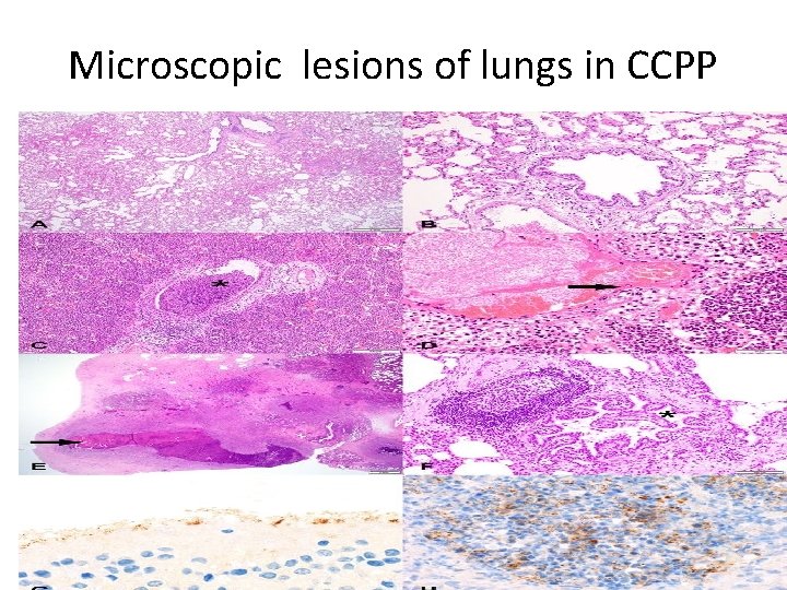 Microscopic lesions of lungs in CCPP 