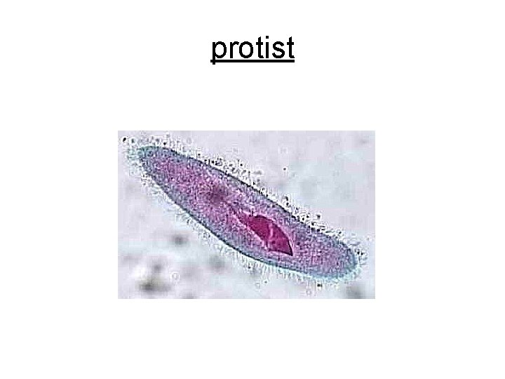 protist 